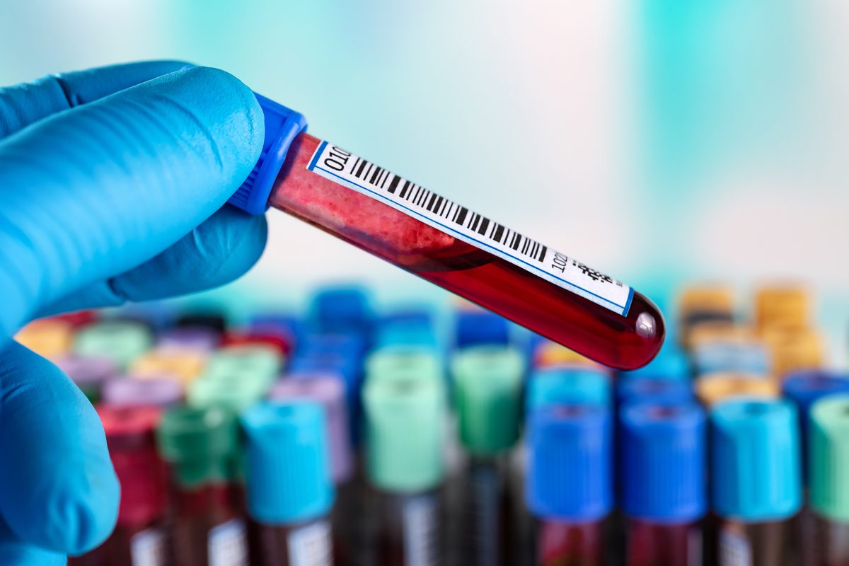 Gloved hand holding a labeled blood sample tube above a rack of colored specimen vials in a testing laboratory. Gloved hand holding a labeled blood sample tube above a rack of colored specimen vials in a testing laboratory.