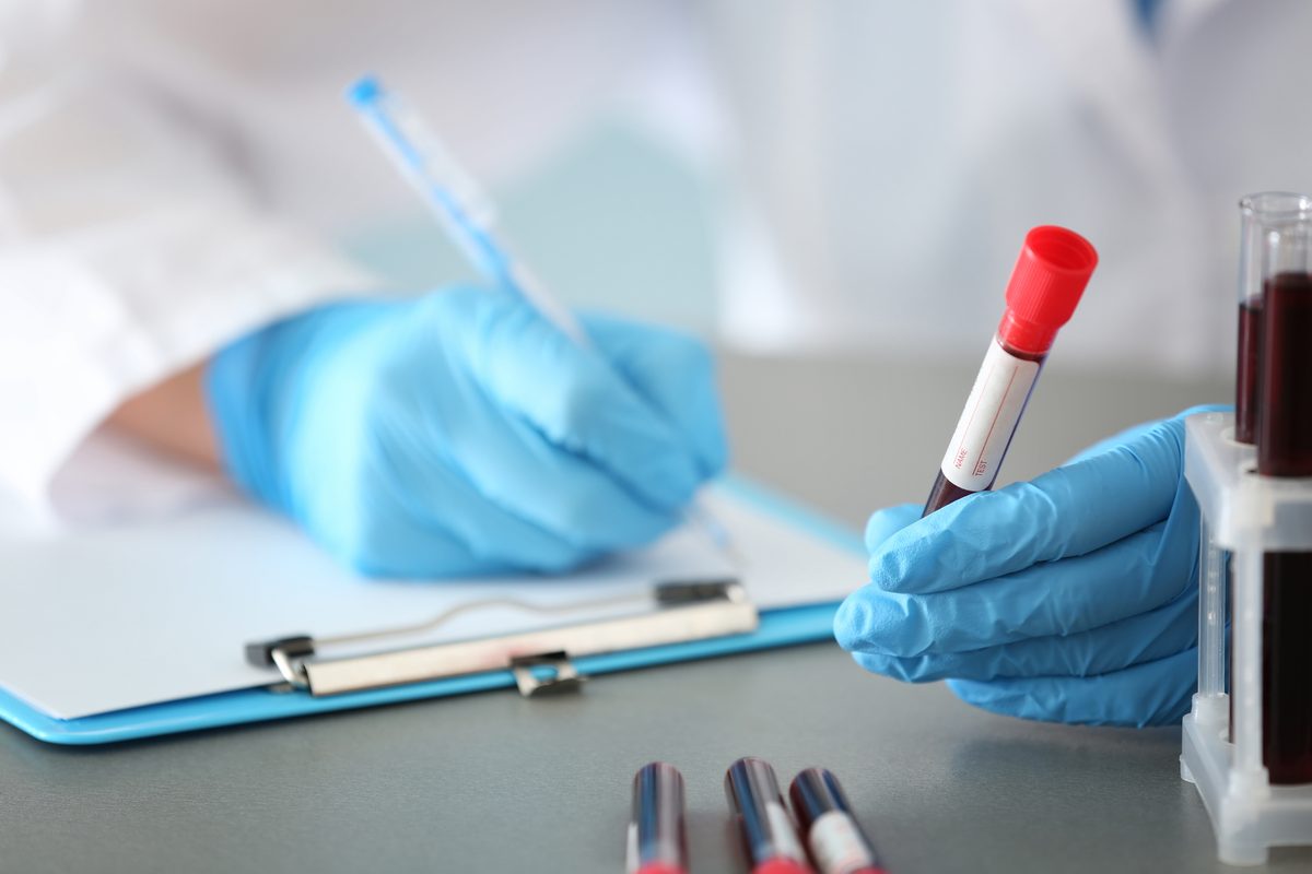 Laboratory technician documenting a sealed blood evidence sample in a forensic lab